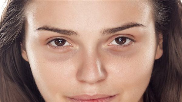 علاج الهالات السوداء حول العينين بالوصفات الطبيعية