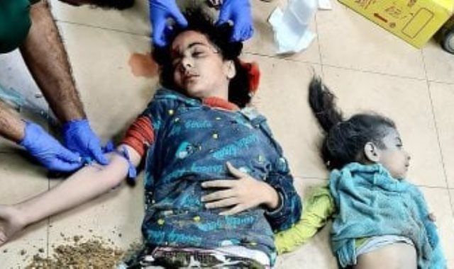 أسوشيتيد برس: العدوان الإسرائيلى على أطفال غزة يُصيب أطباء دوليين بالصدمة