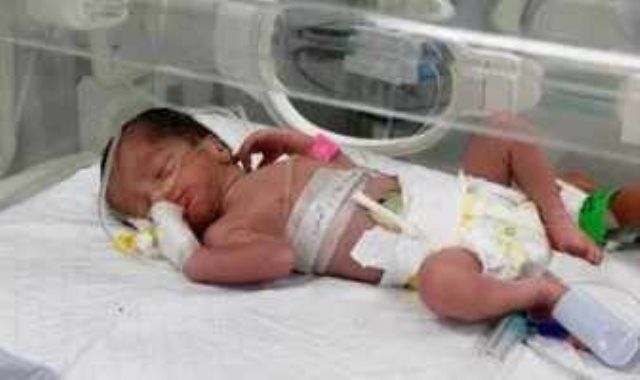 استخراج طفلة من رحم فلسطينية استشهدت بغارة إسرائيلية على منزل فى رفح