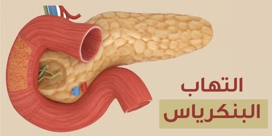 أعراض التهاب البنكرياس، استشاري باطنة يوضح ويحذر من إهمالها