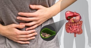 حصوات المرارة المتكررة.. 7 خطوات يوصى بها الأطباء لتقليل مخاطرها